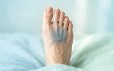 Douleur au coup de pied comprendre les causes et les bons réflexes