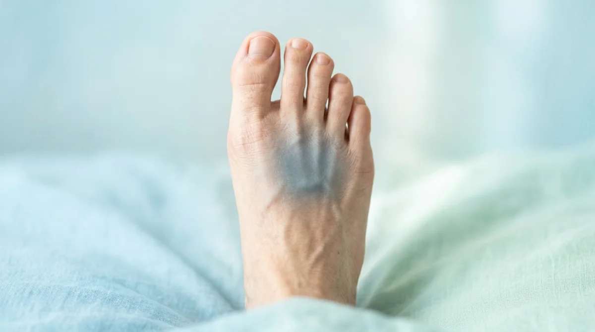 Dessin réaliste d'un pied humain vu de dessus, symbolisant la douleur au coup de pied.